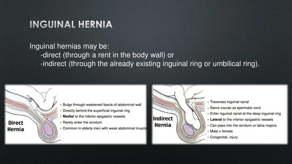 inguinal hernia 1