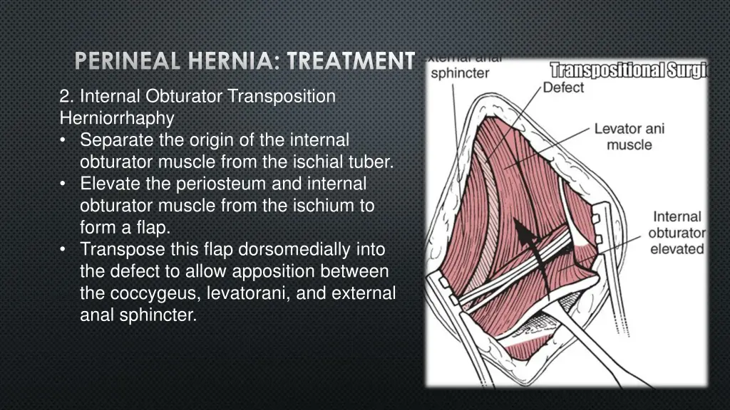 perineal hernia treatment 1