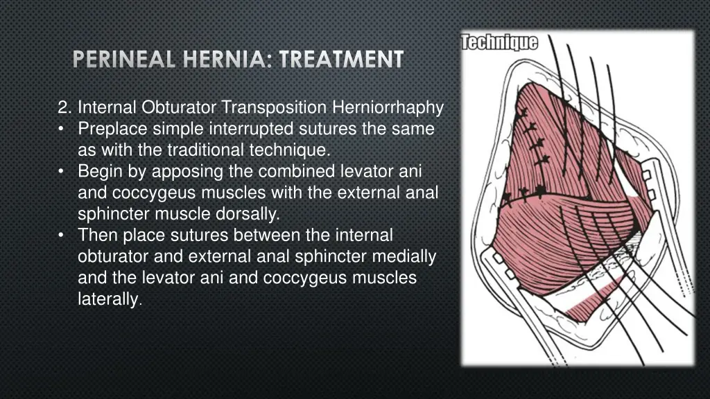 perineal hernia treatment 2