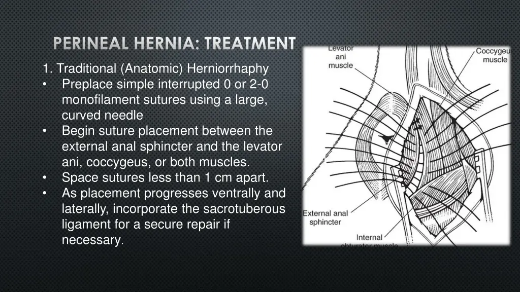 perineal hernia treatment