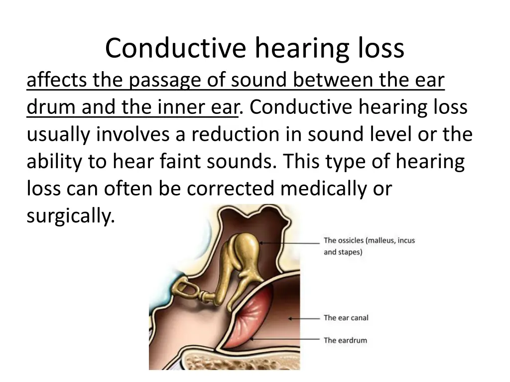 conductive hearing loss affects the passage