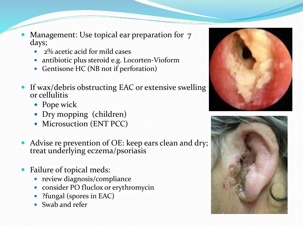 management use topical ear preparation for 7 days