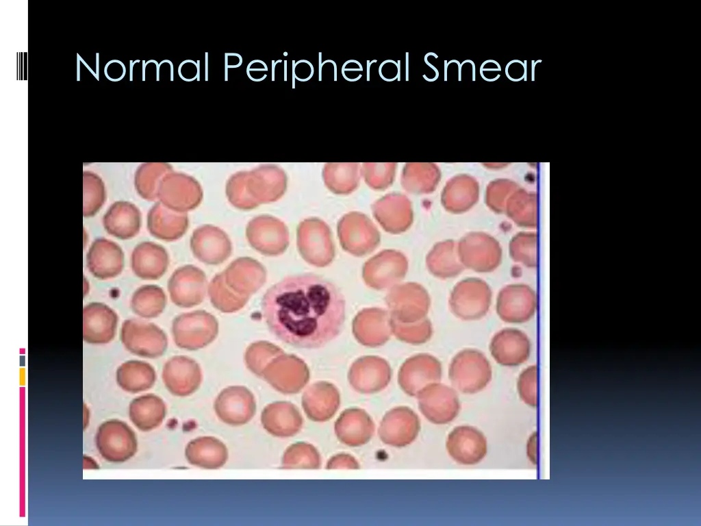 normal peripheral smear