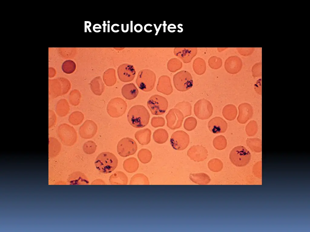 reticulocytes