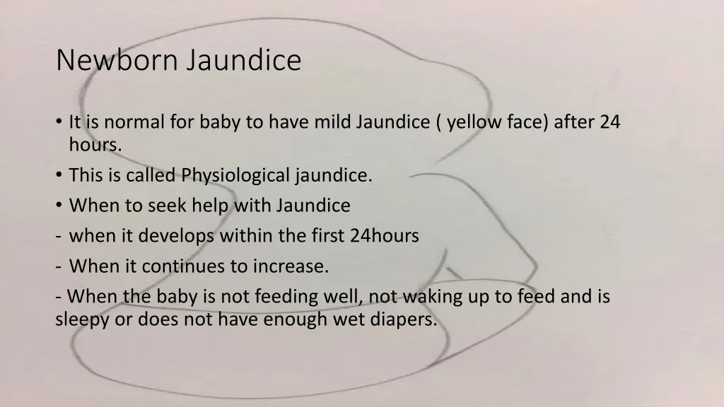 newborn jaundice