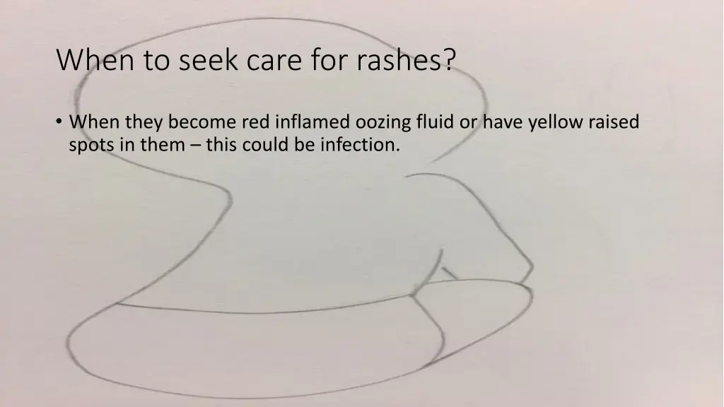 when to seek care for rashes