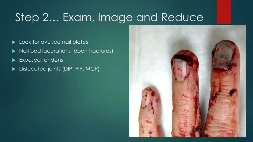 step 2 exam image and reduce