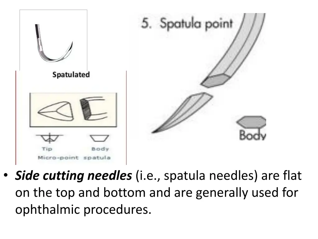 side cutting needles i e spatula needles are flat