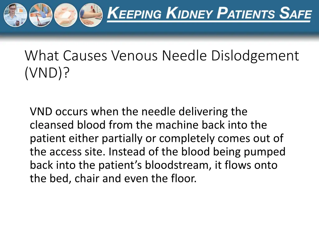 what causes venous needle dislodgement vnd