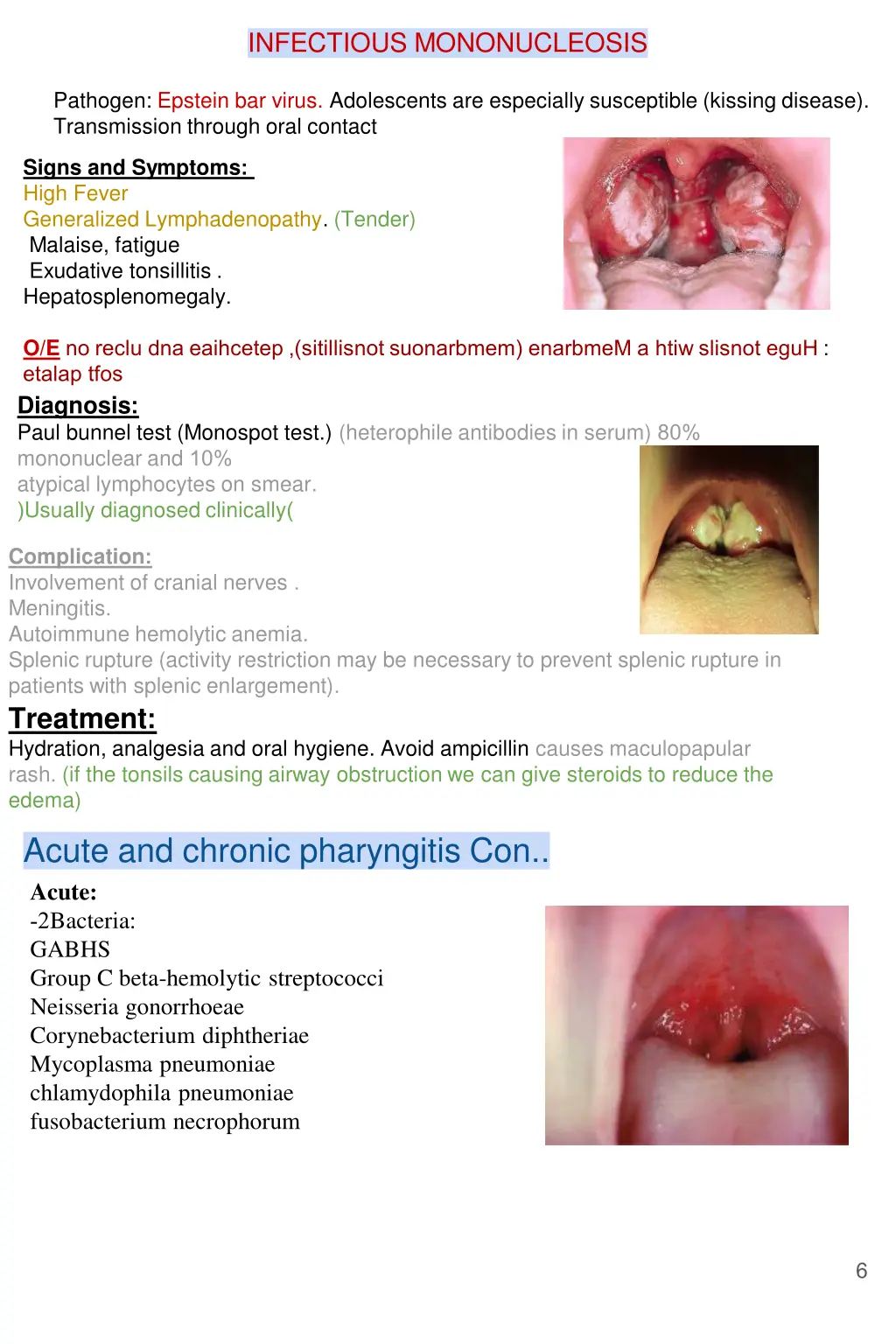 infectious mononucleosis