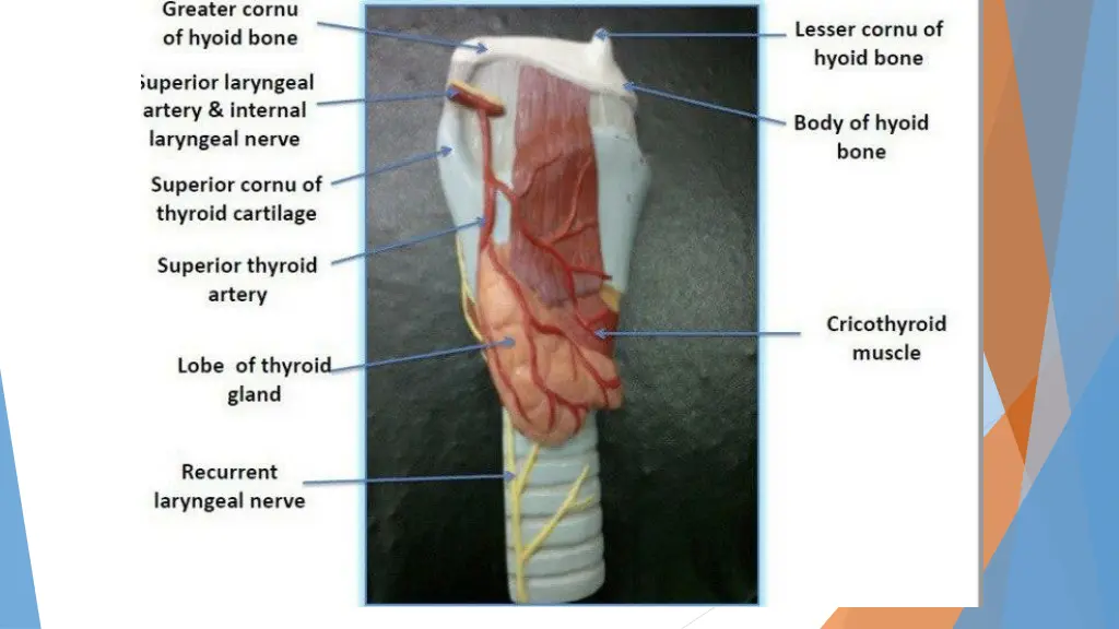 slide18