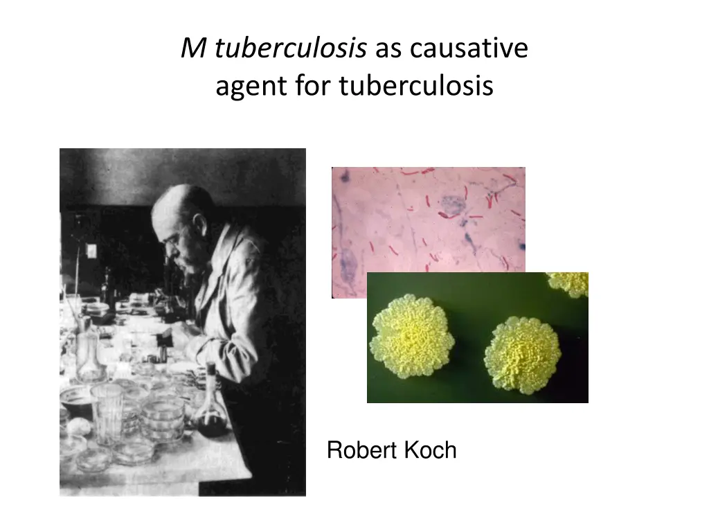 m tuberculosis as causative agent for tuberculosis