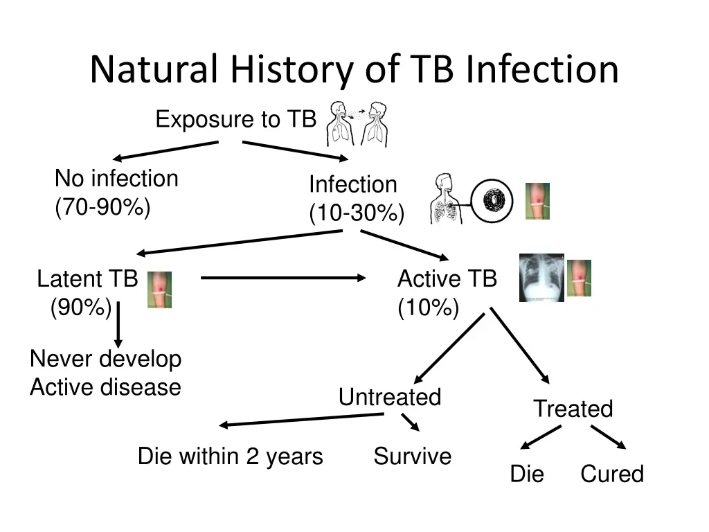 natural history of tb infection exposure to tb