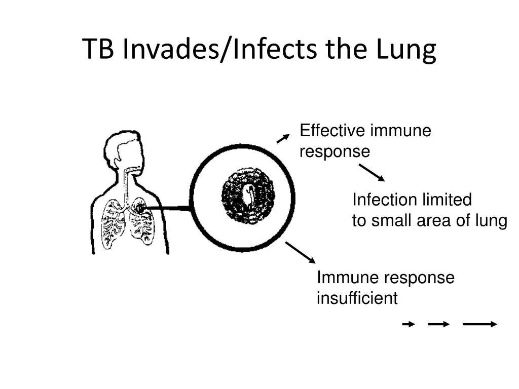 tb invades infects the lung