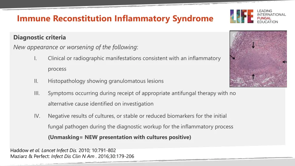 immune reconstitution inflammatory syndrome 2