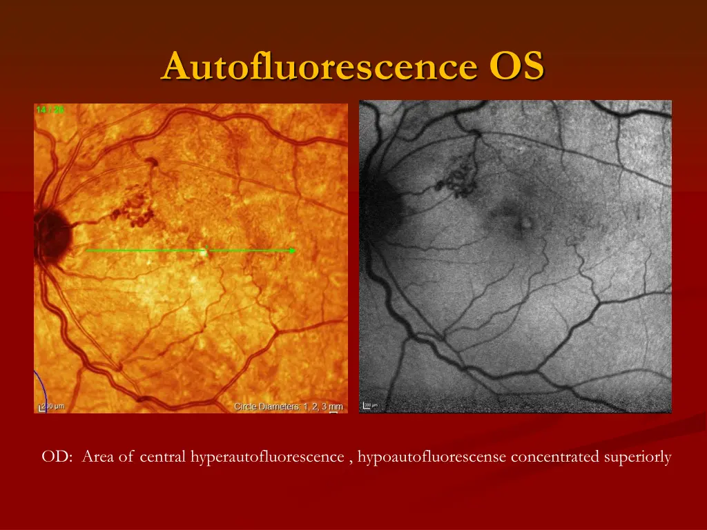 autofluorescence os