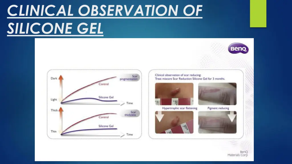 clinical observation of silicone gel 1