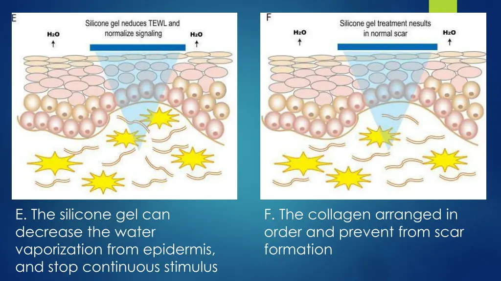 e the silicone gel can decrease the water