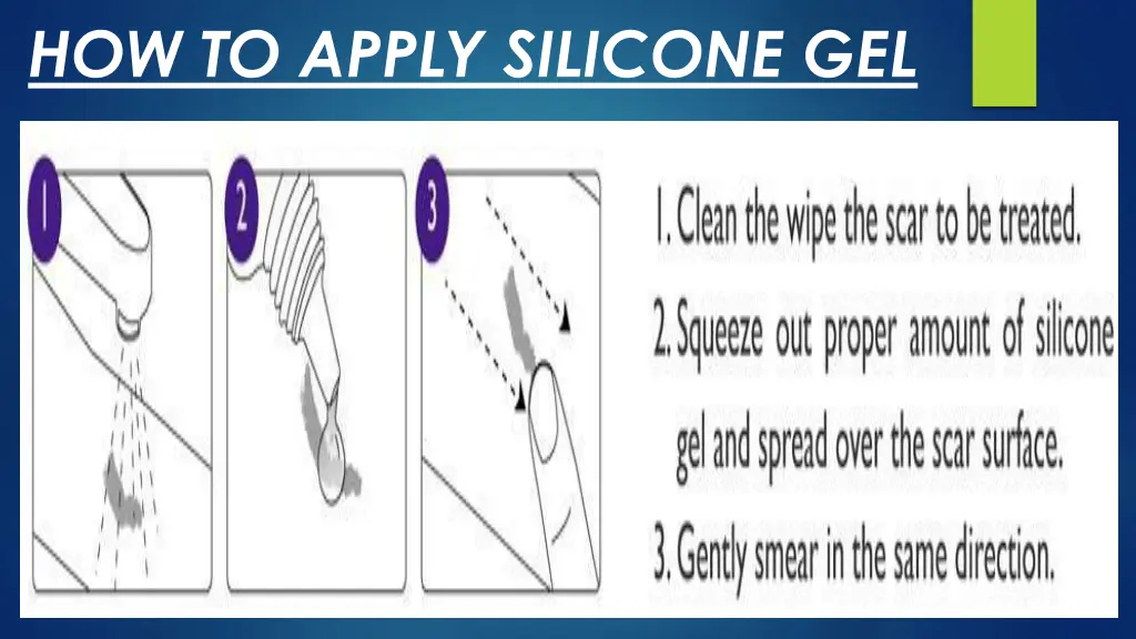 how to apply silicone gel 1