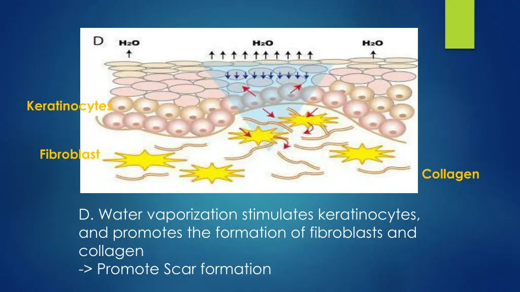 keratinocytes