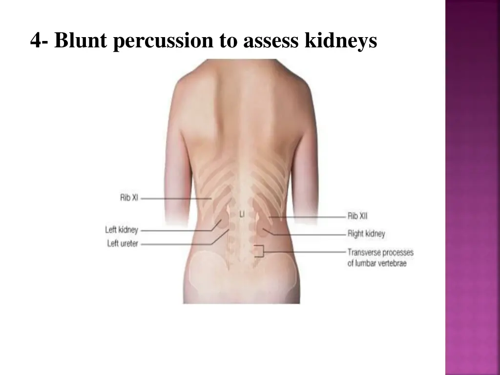 4 blunt percussion to assess kidneys