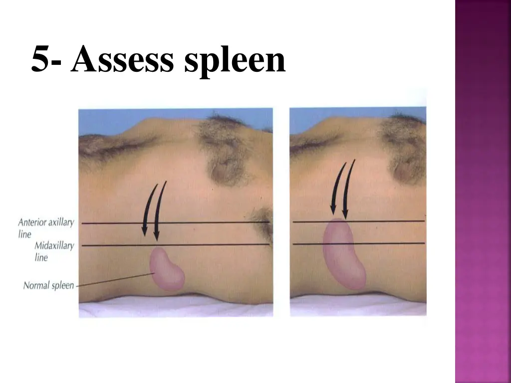 5 assess spleen