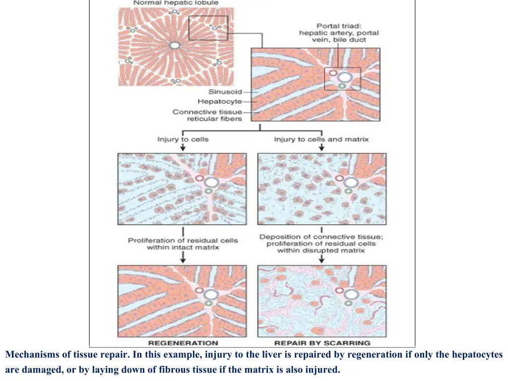 mechanisms of tissue repair in this example