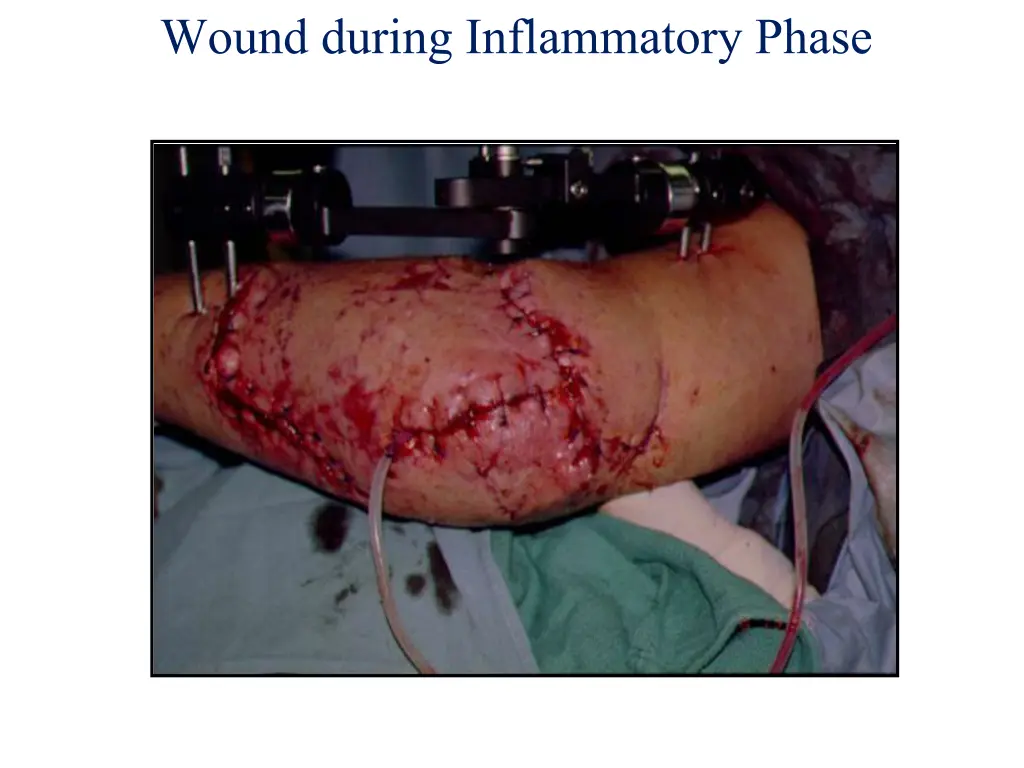 wound during inflammatory phase