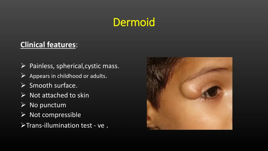 dermoid dermoid