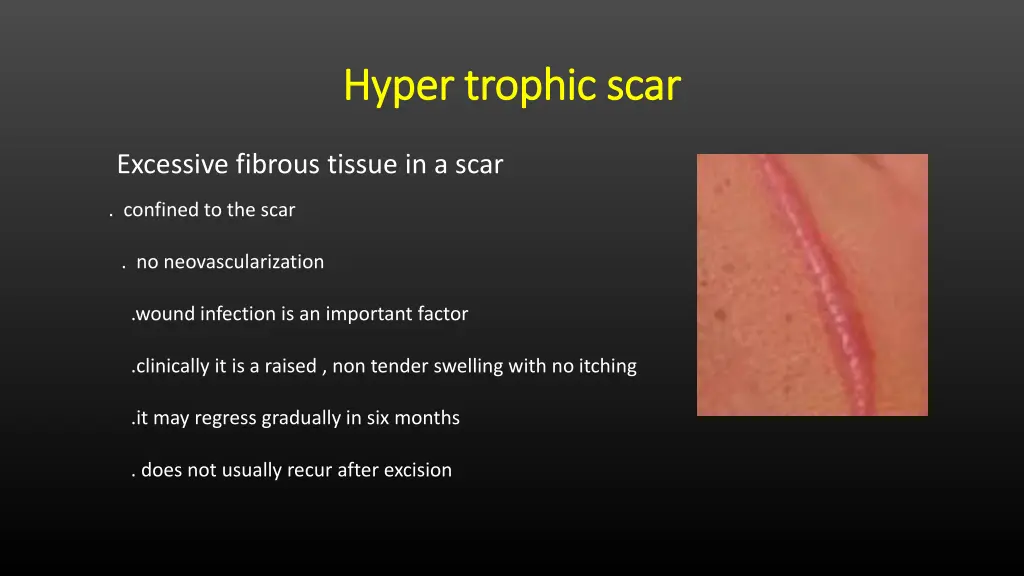 hyper trophic scar hyper trophic scar