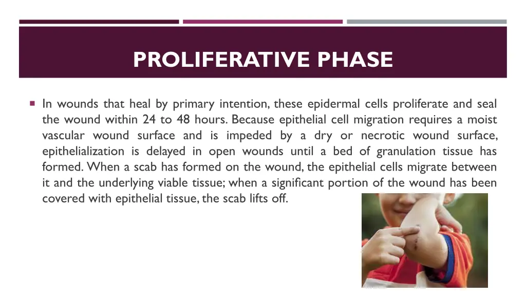 proliferative phase 2