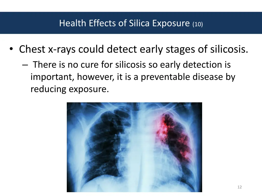 health effects of silica exposure 10