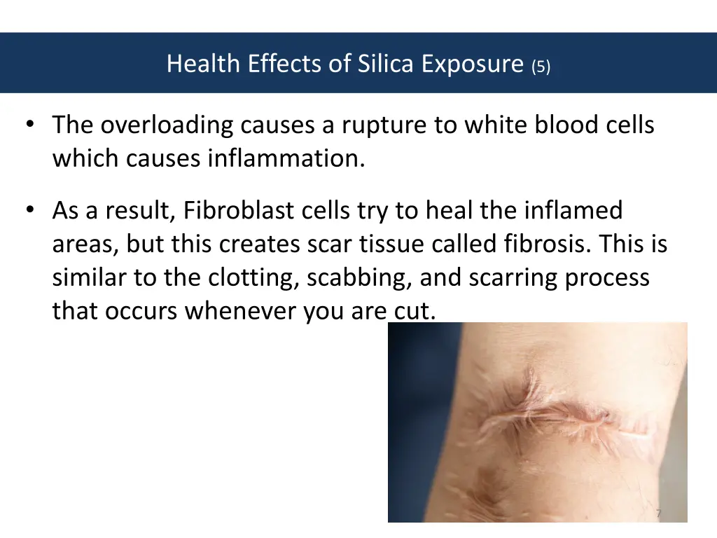 health effects of silica exposure 5