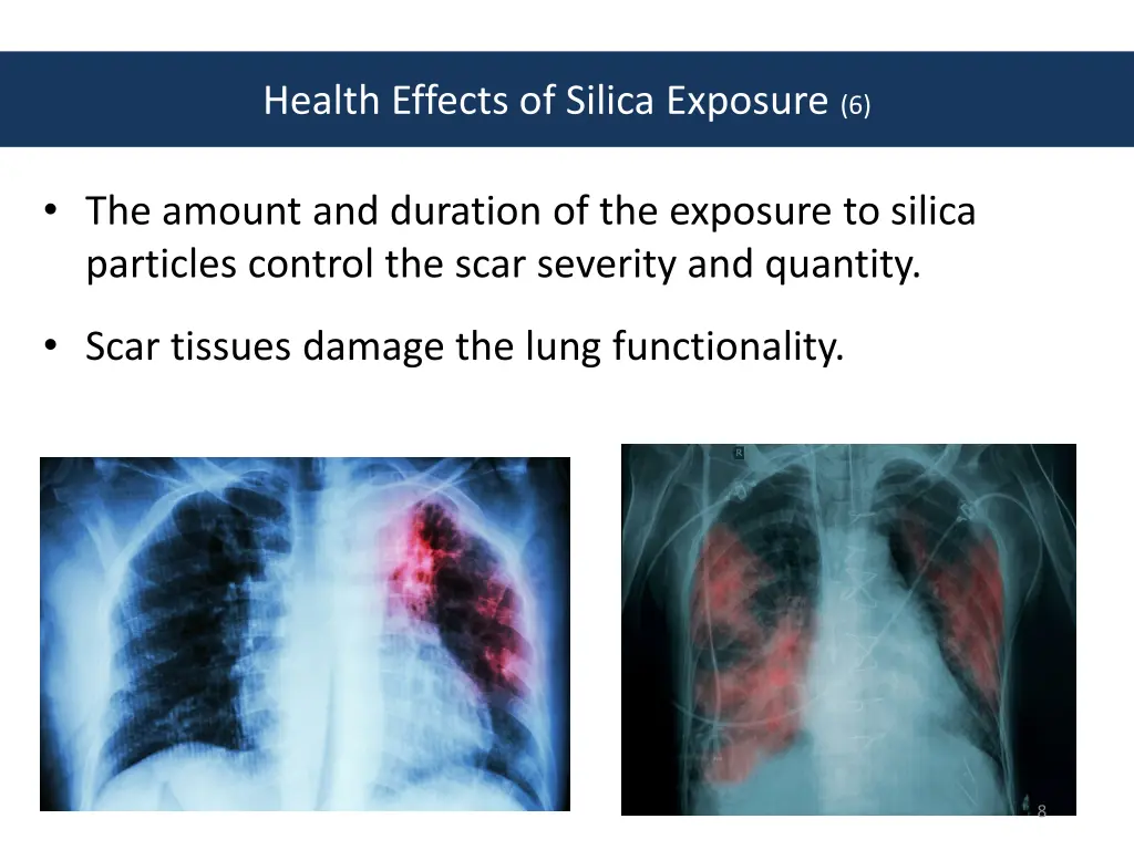 health effects of silica exposure 6