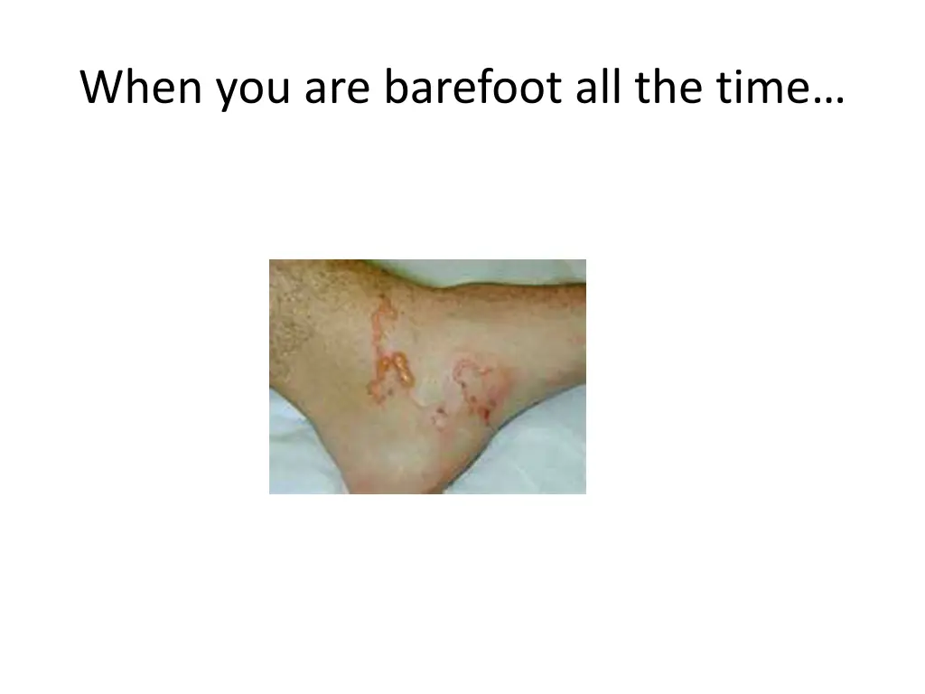 when you are barefoot all the time