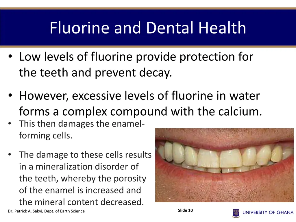 fluorine and dental health 1