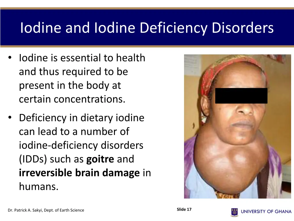 iodine and iodine deficiency disorders