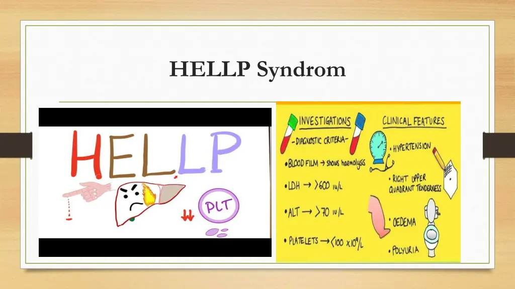 hellp syndrom 1