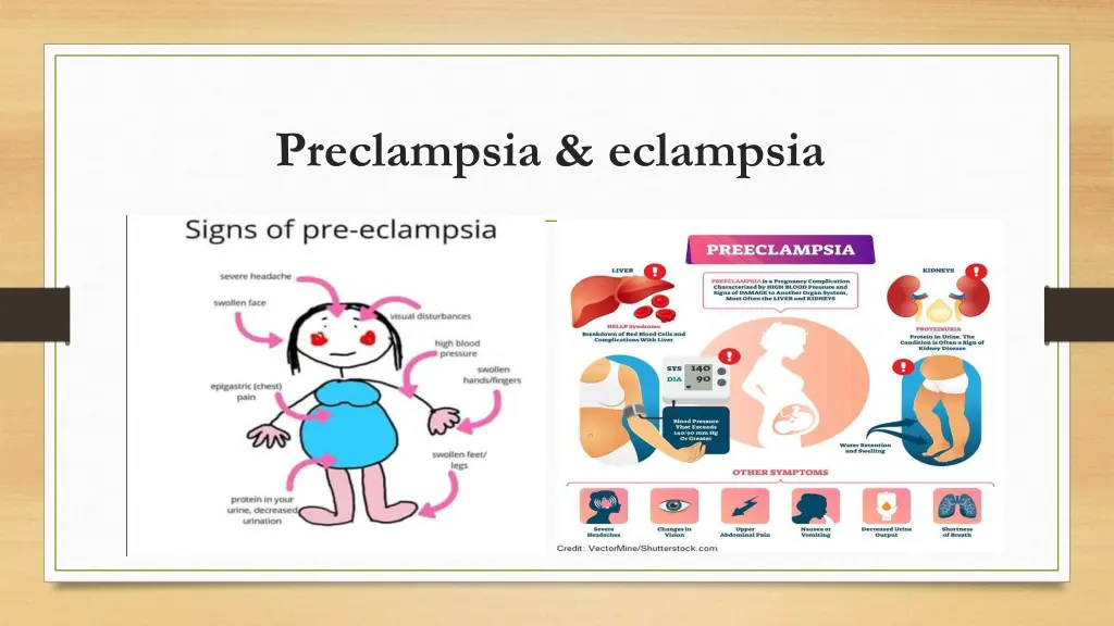 preclampsia eclampsia