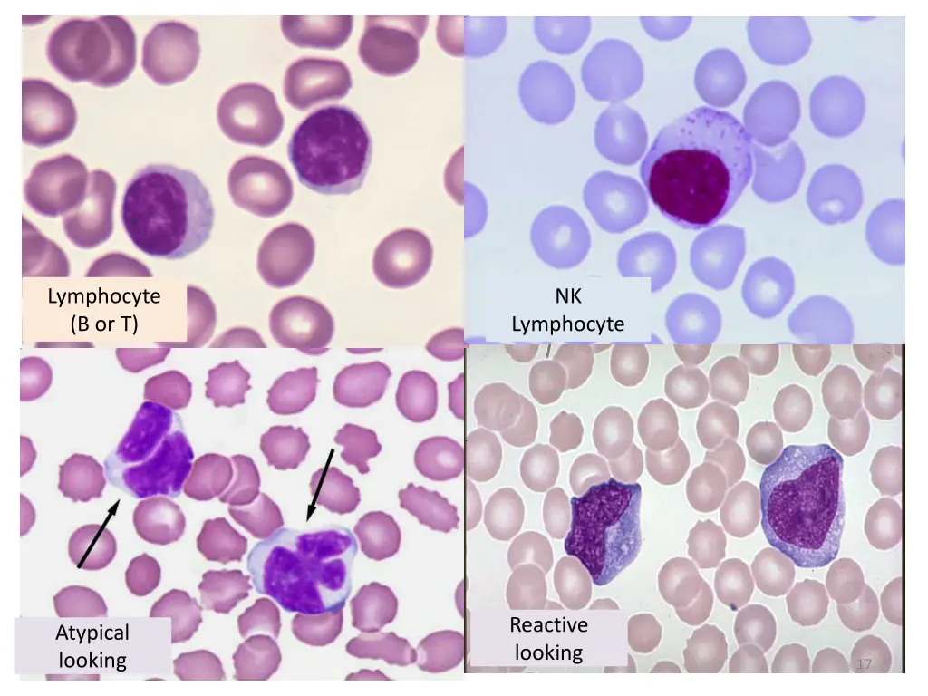 lymphocyte b or t