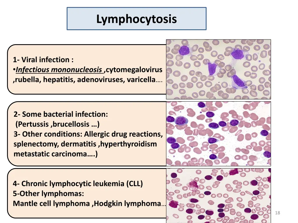 lymphocytosis