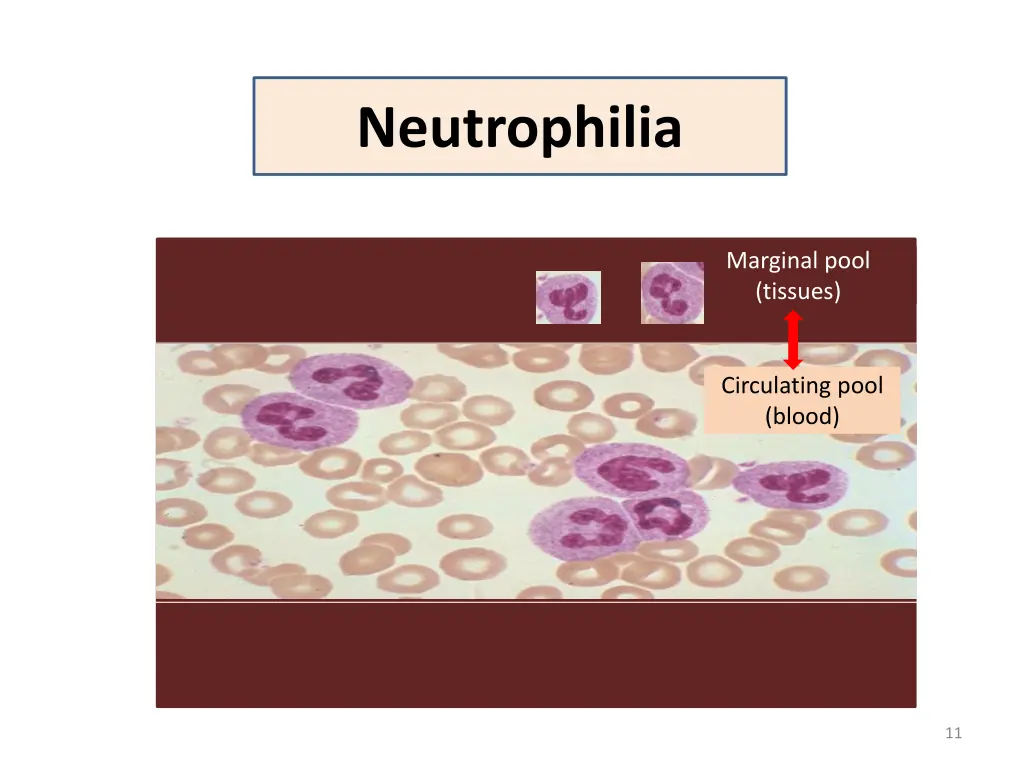 neutrophilia