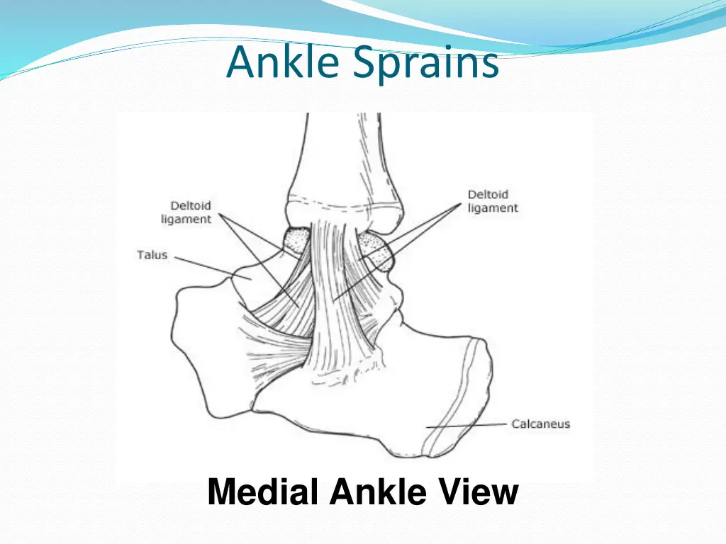 ankle sprains 1