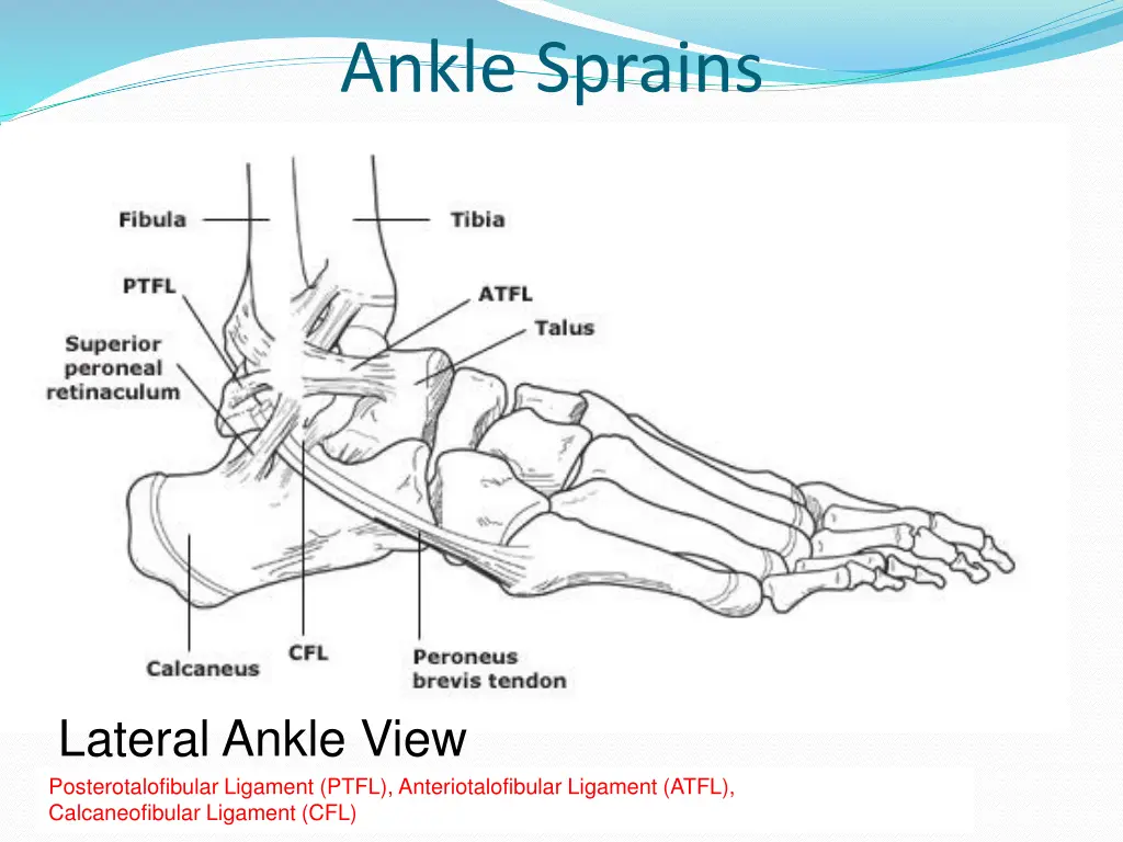 ankle sprains