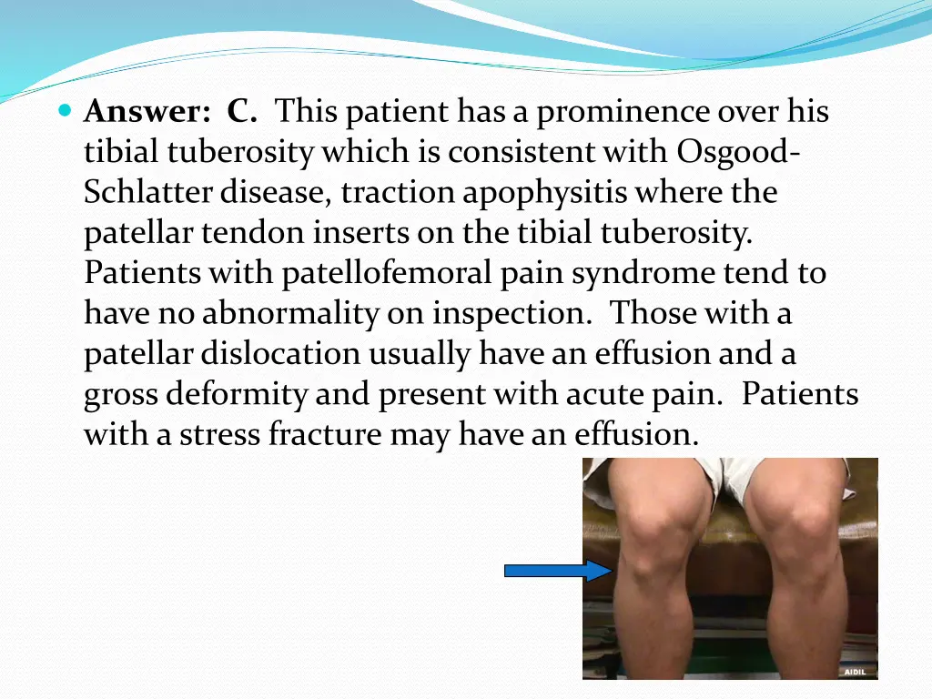 answer c this patient has a prominence over