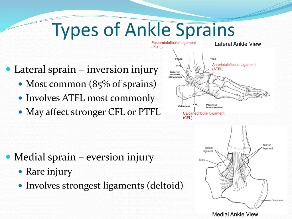 types of ankle sprains