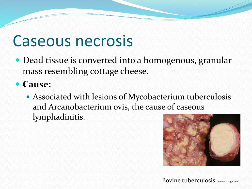 caseous necrosis