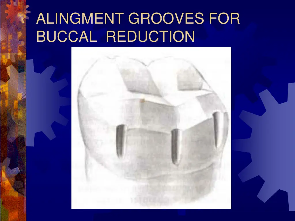 alingment grooves for buccal reduction