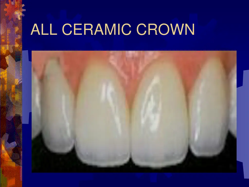 all ceramic crown