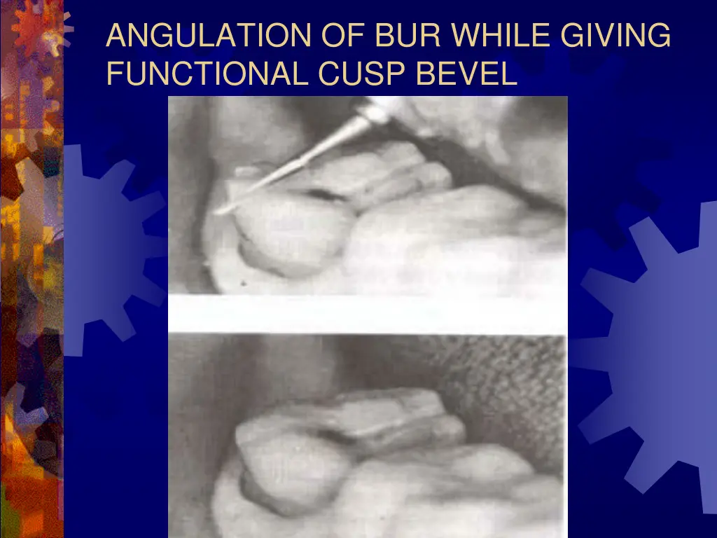 angulation of bur while giving functional cusp